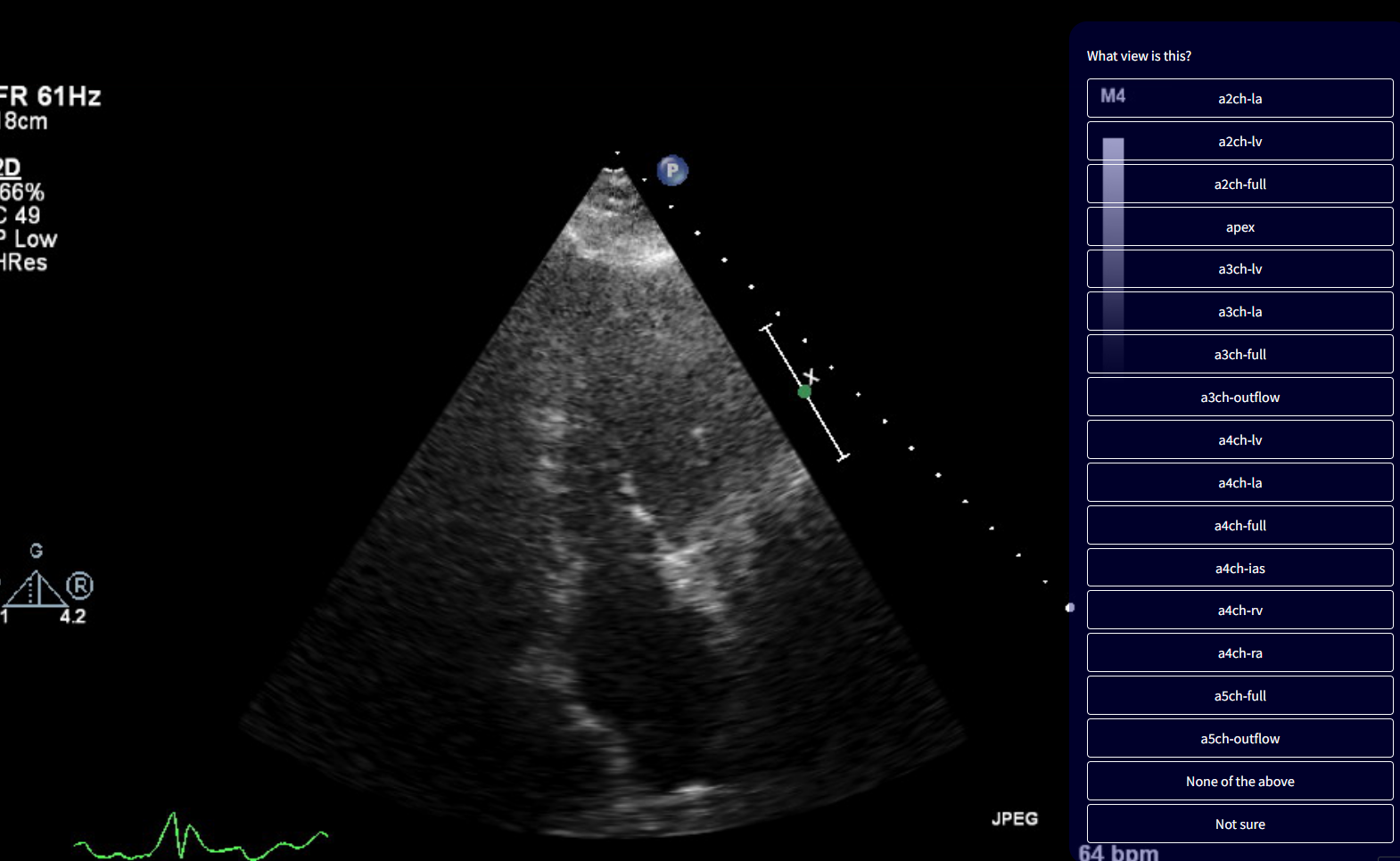 Echo View Classification Example