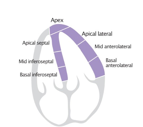 A4C Endocardial Segments