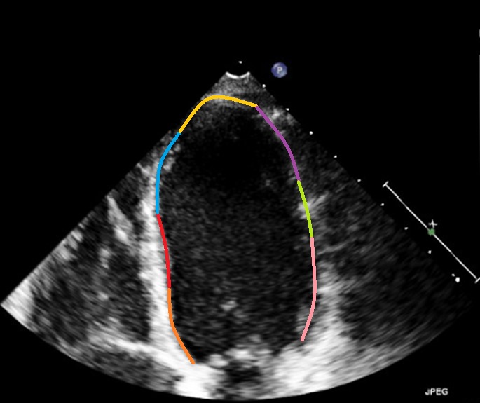 Endocardial Segments