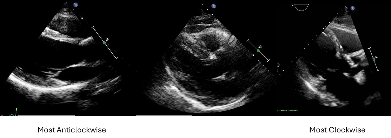 PLAX Orientation Example