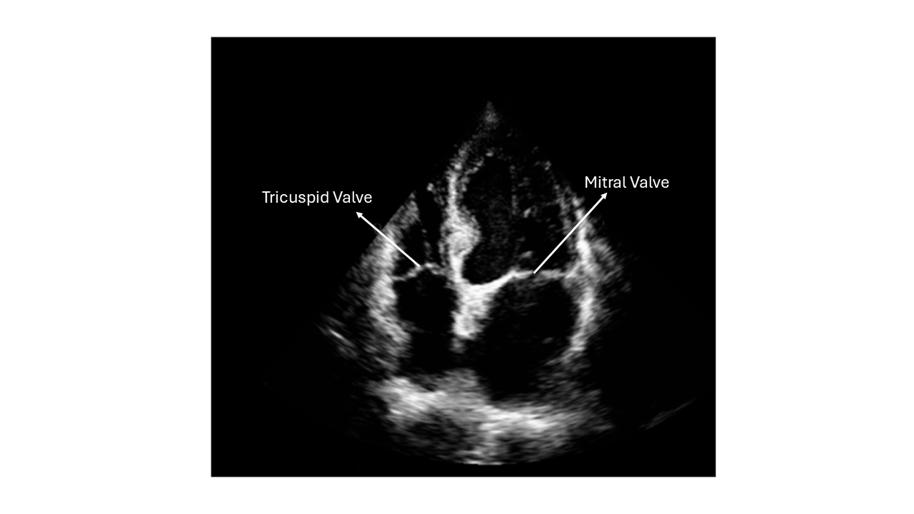 Valve Visibility Example