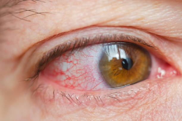 Antibody Mimetics for Ocular Inflammation