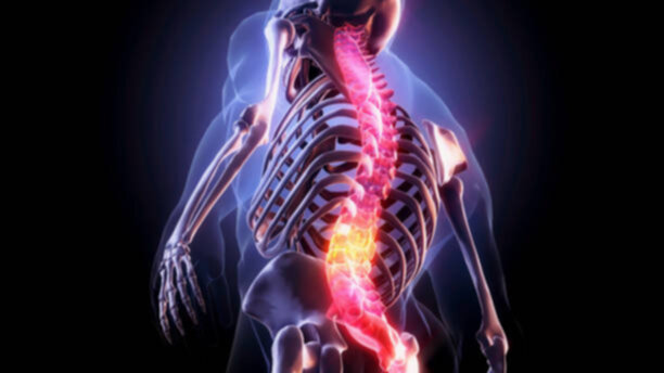 Predictive Modelling for Spinal Fracture
