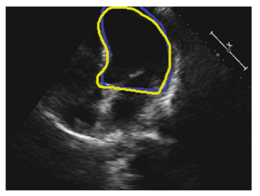 Example Dataset Image