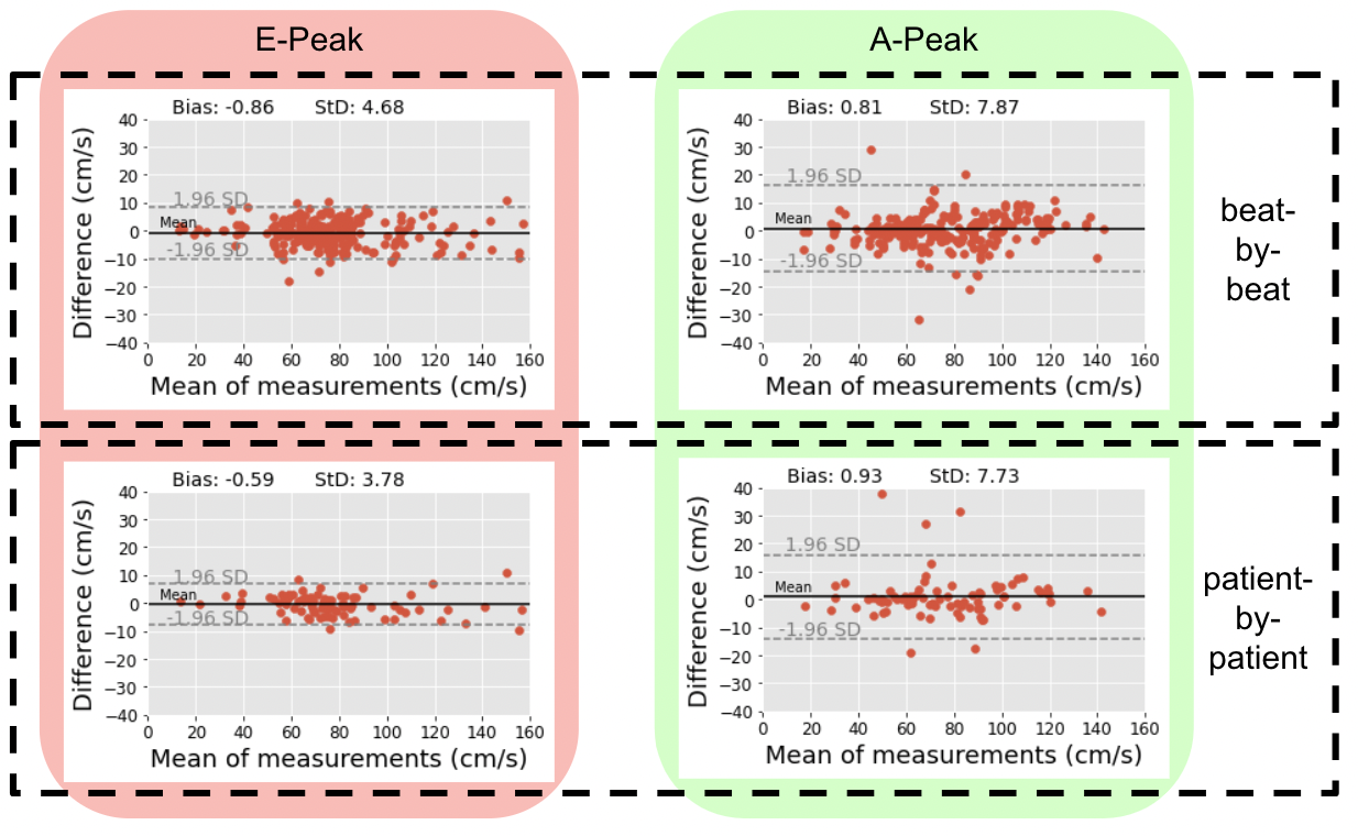 Bland-Altman Plots