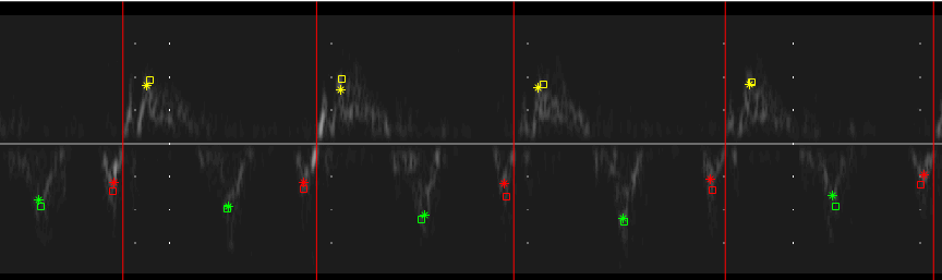 TDI Example Strip