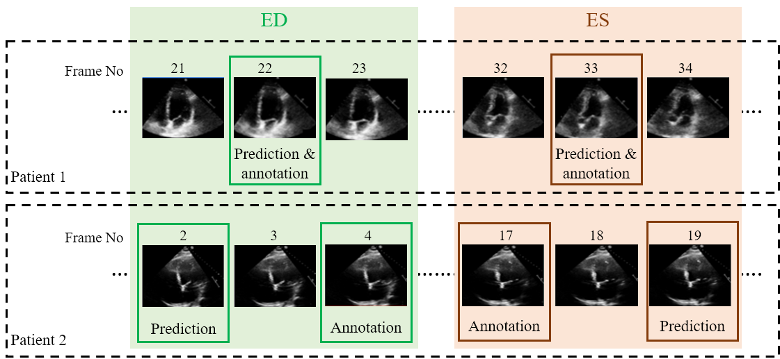 Example Predictions