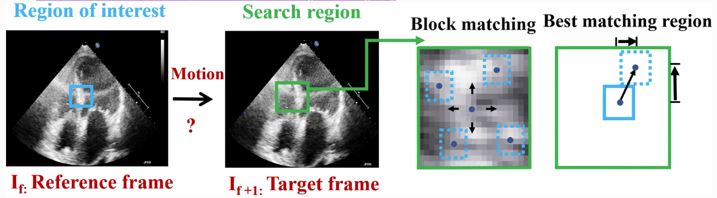 BM Tracking Example